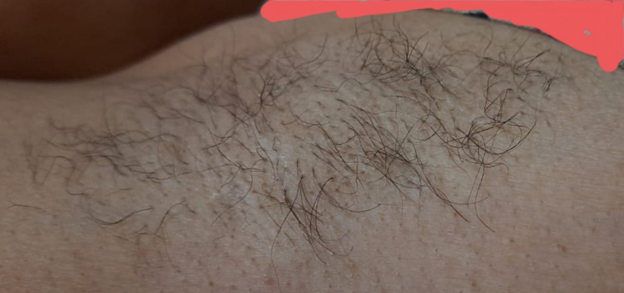 Once again my gf's hairy stinky pits